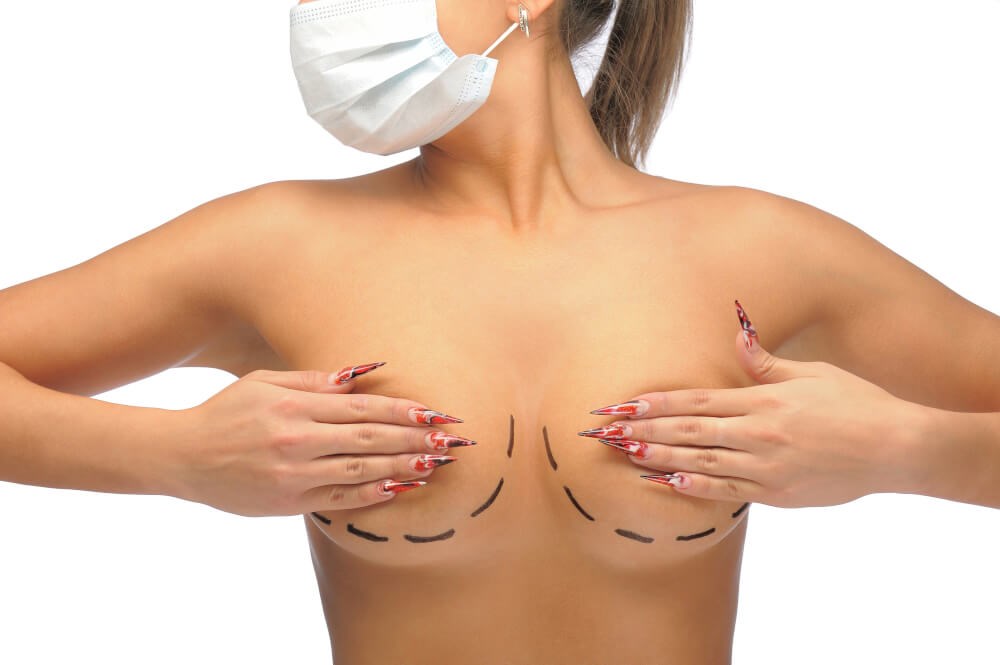 Breast Reduction