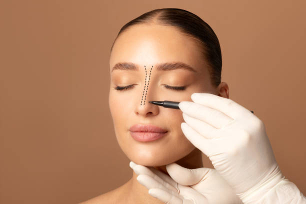 Rhinoplasty