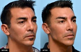 Jaw Line Creation