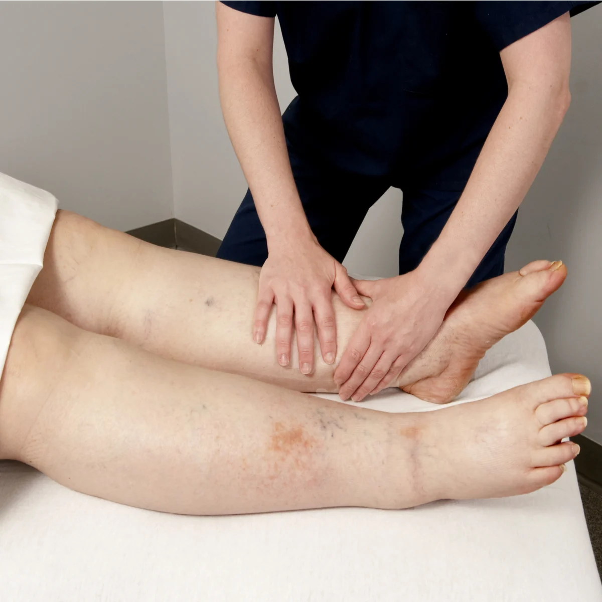 Lymphedema Treatment